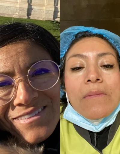 full face